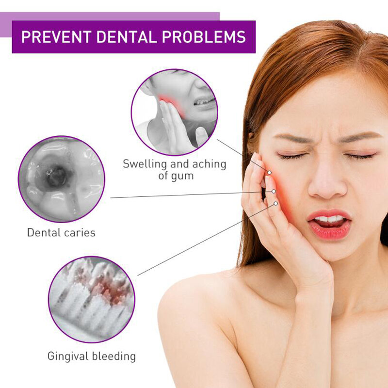 Y-Kelin-أقراص البلاك للكشف عن الأسنان ، عامل الكشف ، أرجواني للبالغين والأطفال ، تنظيف الأسنان ، 12 ، 36 ، 60 علامة تبويب ، 1 ، 3 ، 5 صناديق