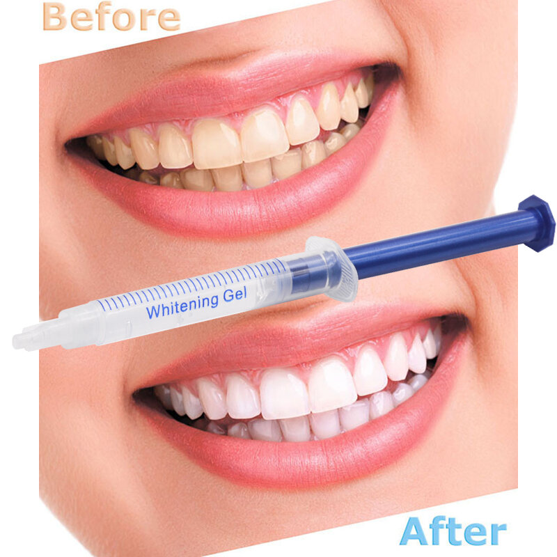 5 قطعة تبييض الأسنان جل ضوء معدات طب الأسنان 44% بيروكسيد التبييض Clareador جل الأسنان أقلام بالجملة طقم تبيض الأسنان