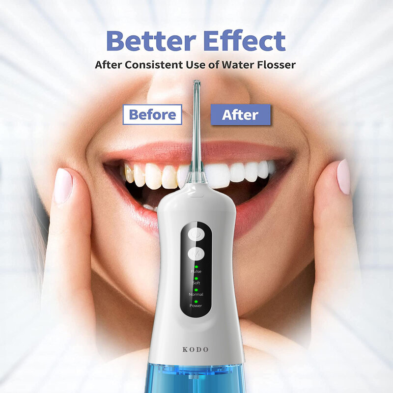 كودو عن طريق الفم الري للأسنان جهاز تنظيف الأسنان بالماء USB قابلة للشحن المحمولة نفاثة مياه للأسنان 300 مللي الري الأسنان الخيط