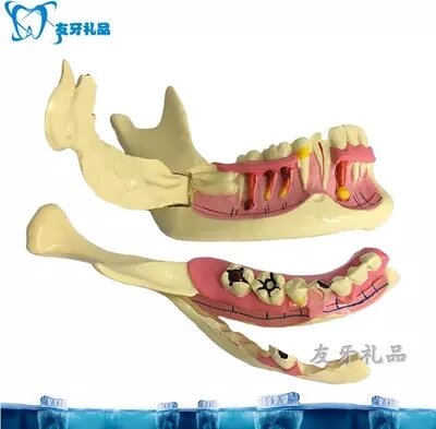 نموذج الأسنان الأيمن الفك السفلي نموذج التحلل عن طريق الفم نموذج التسوق المجاني