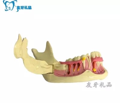 نموذج الأسنان الأيمن الفك السفلي نموذج التحلل عن طريق الفم نموذج التسوق المجاني