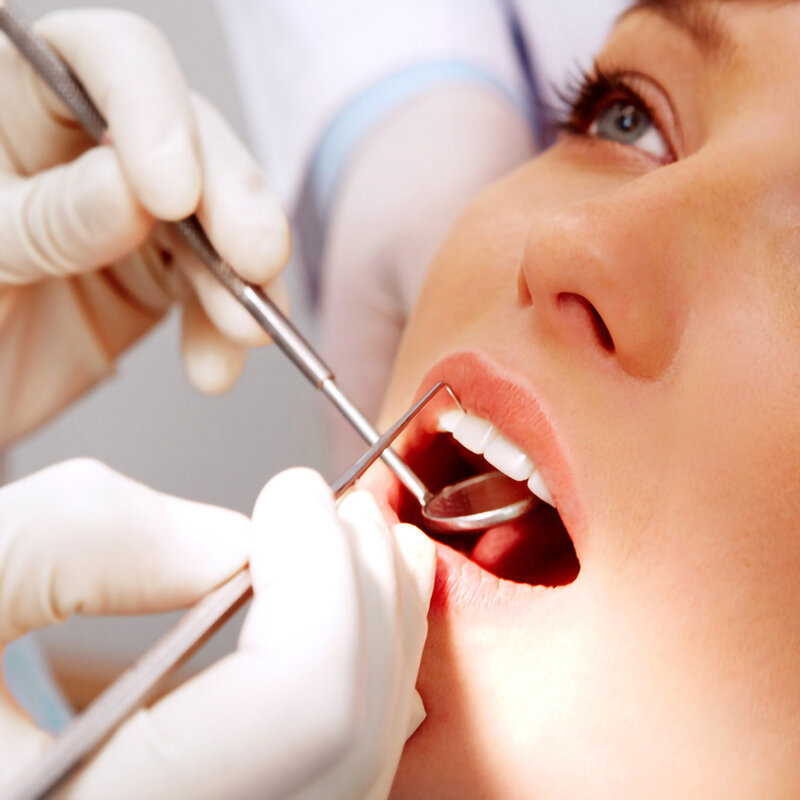 مكشطة الجير اختيار الأسنان تنظيف الأسنان طب الأسنان تصميم مزدوج نهاية الفولاذ المقاوم للصدأ Odontologia المنزلية مع مرآة الأسنان