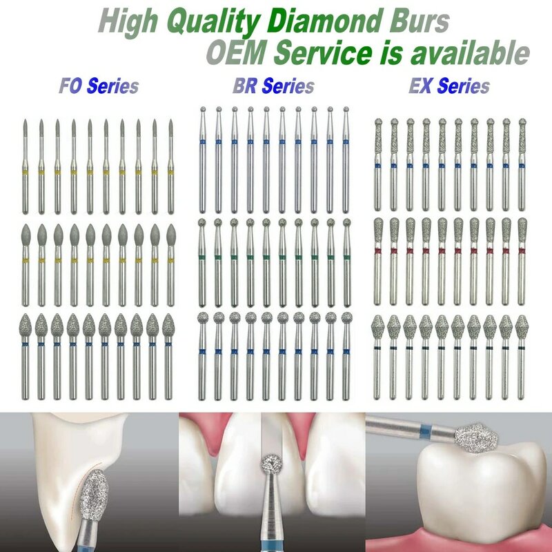 الأزيز الماس الأسنان للحصول على قبضة عالية السرعة ، حشوات طب الأسنان ، الحد من الحمل و الإقفال ، تجويف وإعداد ، 10 قطعة