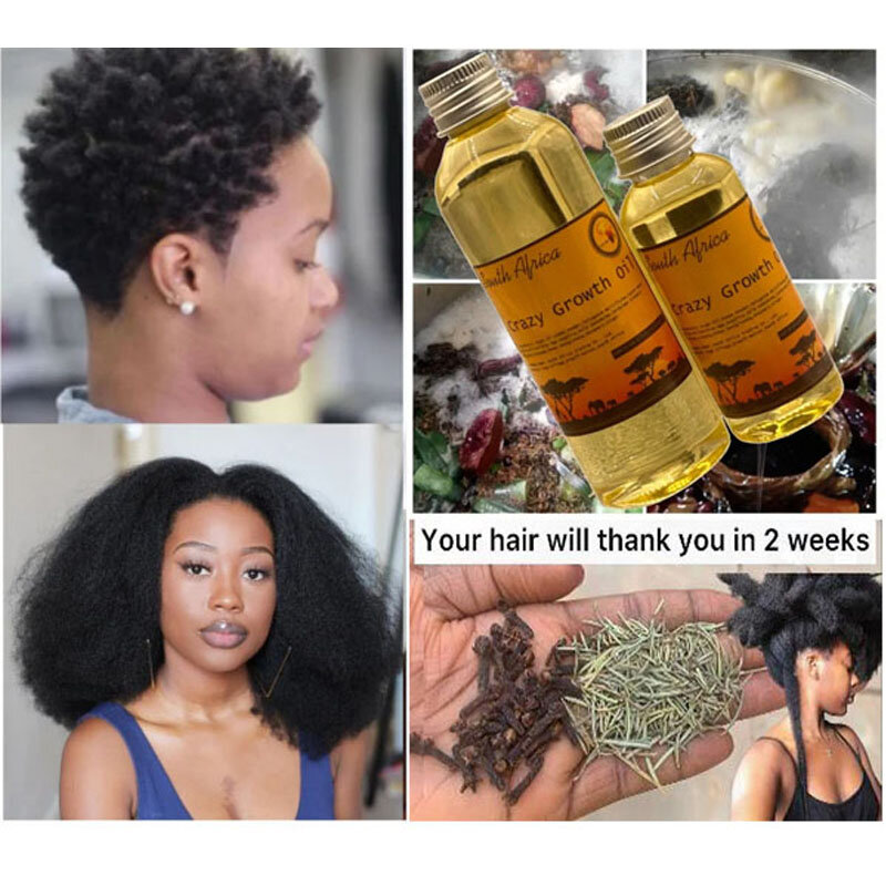 زيت نمو مجنون تقليدي مصنوع يدويًا من أفريقيا ، فقط 10-30 ، ينمو شعرك ، ويكبر الشعر خلال أسبوعين