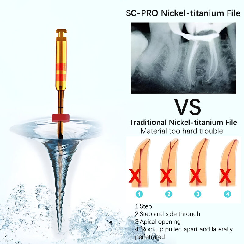 ملف قناة جذر الأسنان من COXO SOCO SC PRO ، نيتينول دوار تنشيط للحرارة ، ملفات لب الأسنان ، نيكل-تيتانيوم المنشط حراريًا