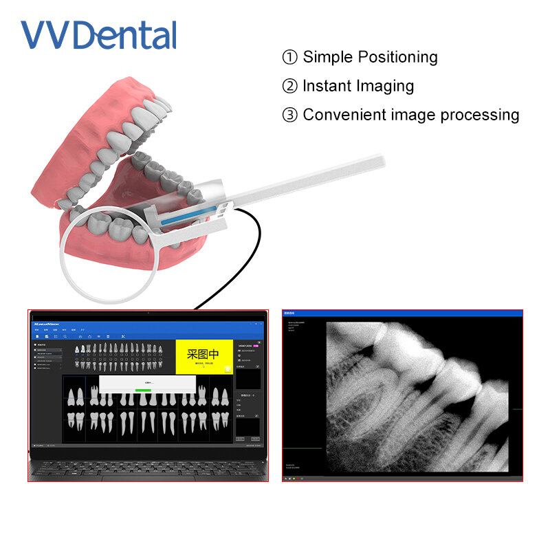 جهاز استشعار الأسنان بالأشعة السينية الرقمية ، جهاز تصوير بالأشعة السينية ، نظام تصوير داخل الفم ، صورة عالية الدقة ، أداة طب الأسنان ، VVDental