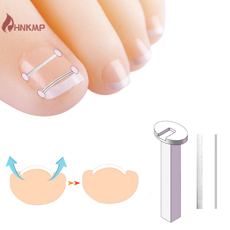 أدوات مصحح أظافر القدم الناضج لعلاج الأظافر ، علاج أظافر أصابع القدم ، تصحيح أظافر القدم ، أداة العناية بالقدم