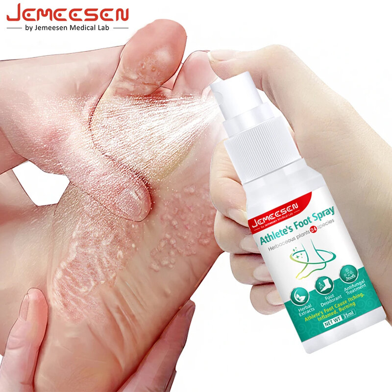 جيميسين-كريم علاج طبيعي مضاد للرائحة بالأعشاب ، مضاد للحكة ، تقشير ، أقدام رياضية