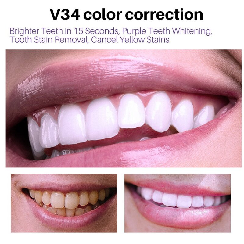 V34 معجون أسنان موس ، مصحح تنظيف الأسنان ، تبييض تفتيح ، العناية بالأسنان ، تقليل الاصفرار ، 50: 50