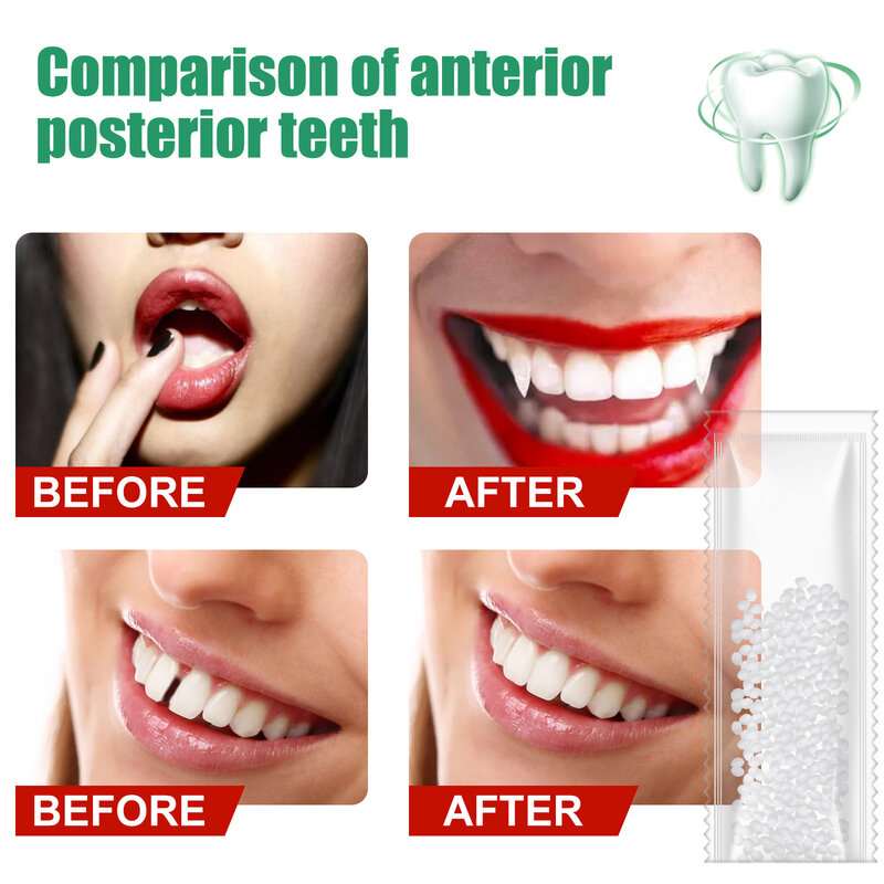 الراتنج إصلاح الأسنان الغراء تشكيل الأسنان الثغرات ملء الصلبة الغراء المؤقتة إصلاح الأسنان Falseteeth الغراء سلامة لوازم طب الأسنان