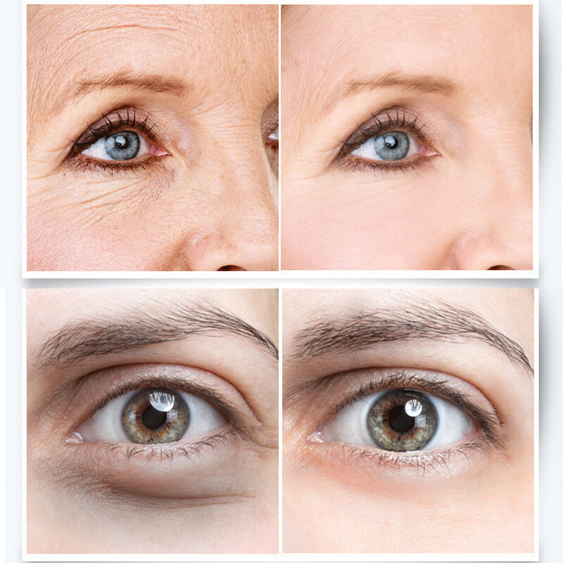 ريتينول ترطيب مكافحة الظلام دائرة العين كريم المضادة للتجاعيد أنيت الشيخوخة إزالة أكياس العين الانتفاخ العناية بالبشرة سطع ثبات