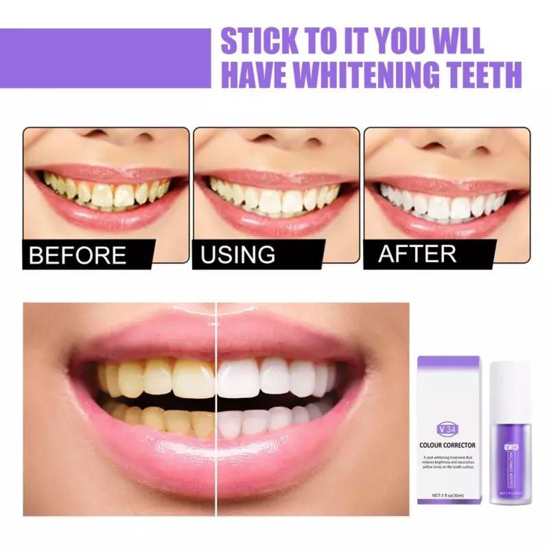 V34 مصل مصحح ملون معجون اسنان لتبييض الاسنان V34 مصحح الالوان مهني لتبييض الاسنان النظافة