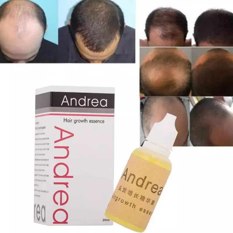 20 مللي فقدان الشعر اندريا الزيوت الأساسية السائل كثيفة Huile أساسيات سريع Sunburst تنمو استعادة بيلاتوري