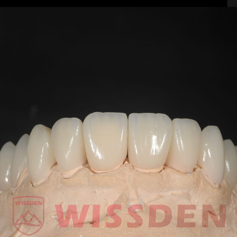 مكعبات أسنان سيراميك مع مكعبات ليثيوم ديسيليكات ، مكعبات أسنان سيراميك ، C14 Wissden ، CAD وcam ، أفضل تعليقات فورية للعملاء ، 5 ،
