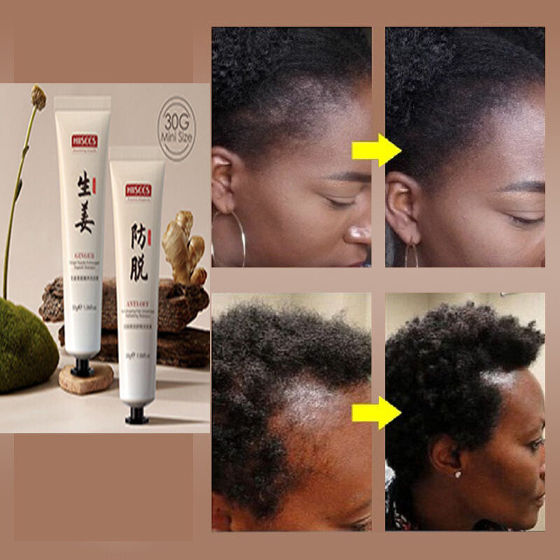 وصفة سرية قديمة لعلاج نمو الشعر الشامبو البرية تنمو الشعر مكافحة تساقط الشعر يمكن استخدامها للصلع