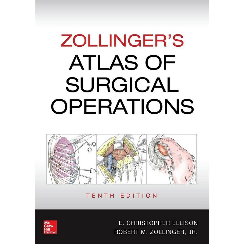 اصدار زولينجر للقوى الجراحية ، الطبعة العاشرة
