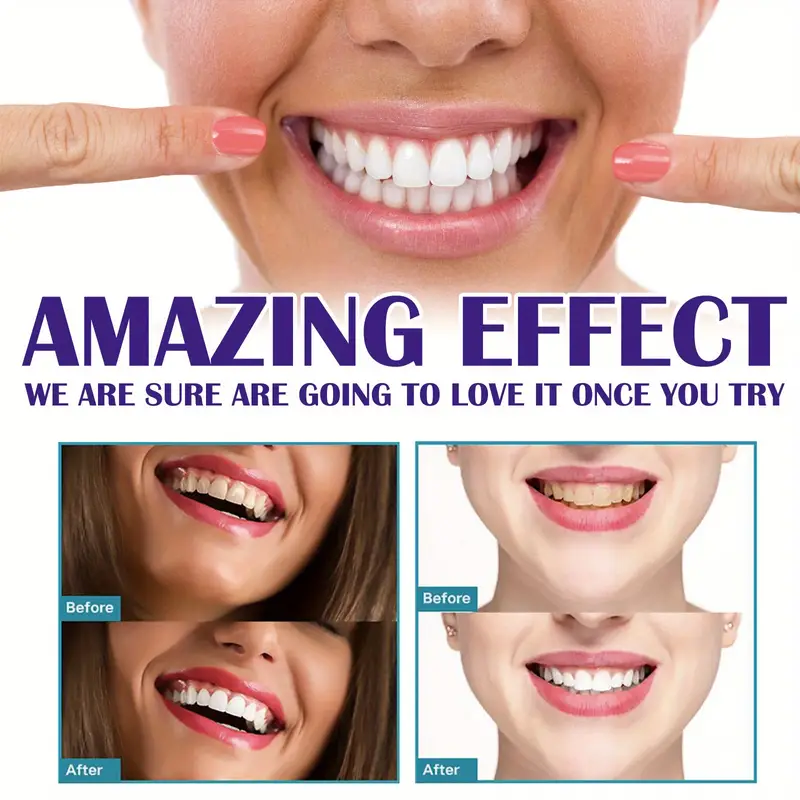 معجون أسنان تبييض فعال ، إزالة الأسنان الصفراء ، وصمة عار الأسنان ، منتج تنظيف الفم ، موس V99 ، 60 مللي