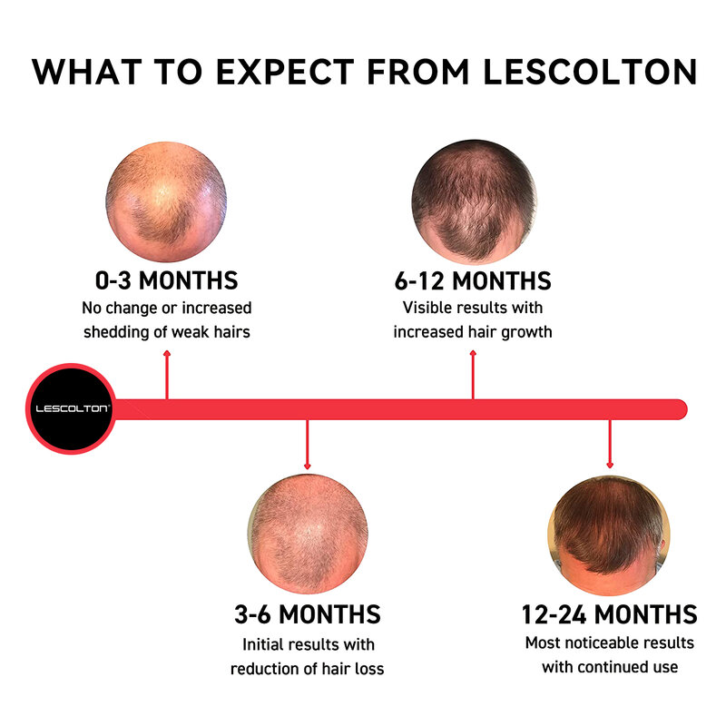 LESCOLTON نمو الشعر خوذة الأشعة تحت الحمراء ضوء الليزر خوذة علاج تساقط الشعر للرجال والنساء مكافحة فقدان الشعر غطاء إعادة نمو الشعر