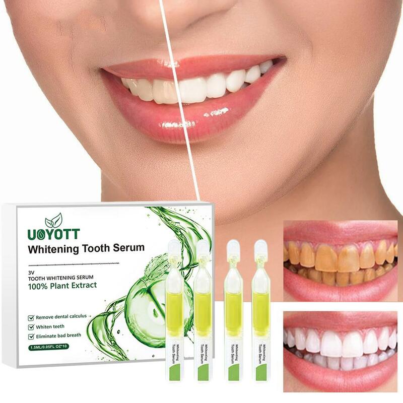 طبيعي النعناع نكهة تبييض الأسنان جوهر ، العناية بالفم ، تنظيف أمبولة مصل ، يزيل البقع ، معجون أسنان فعال ، E4N0 ، 15 مللي