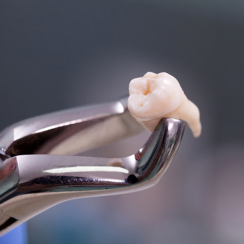 الأسنان الملقط الأسنان استخراج Forcep كماشة عدة 7 قطعة للطفل و 10 قطعة للكبار الفولاذ المقاوم للصدأ تقويم الأسنان أدوات طب الأسنان