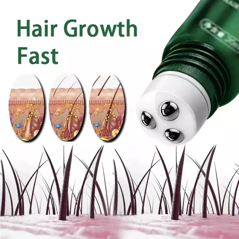زيت نمو الشعر السريع ، إصلاح الصلع الفعال ، فقدان ما بعد الولادة الوراثي ، تساقط الشعر الدهني