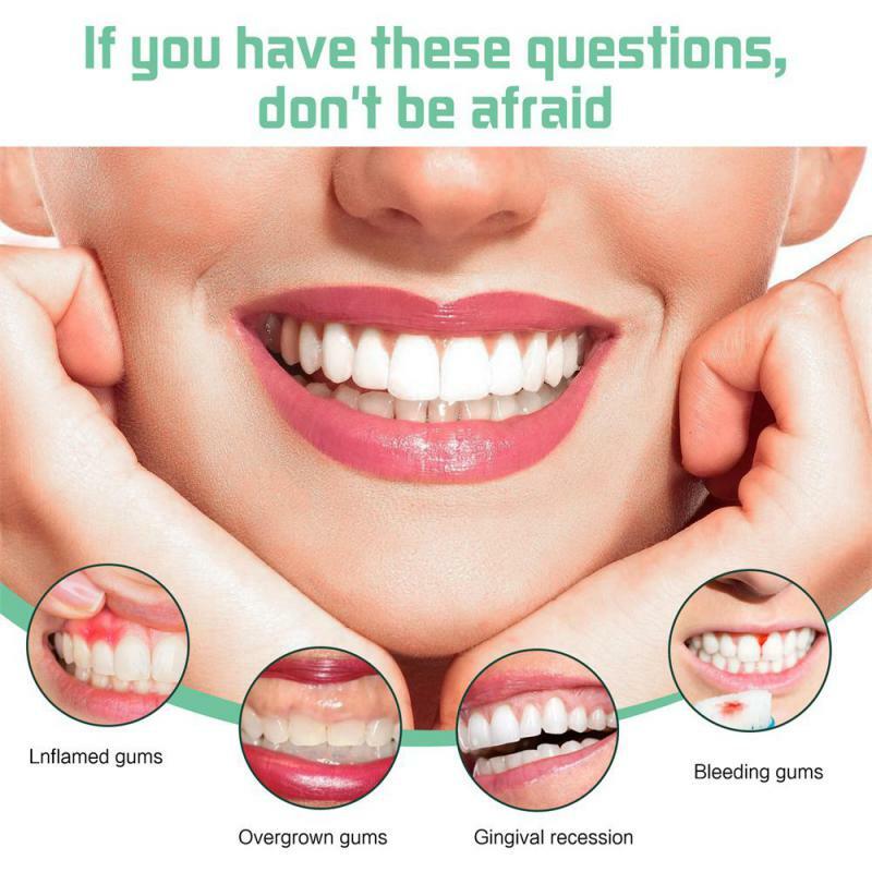 اللثة-قطرات إصلاح الأسنان ، صمغ الأسنان ، تخفيف تقرحات اللثة ، العناية بتنظيف الفم ، العلاج ، رائحة الفم الكريهة ، مضادات البكتيريا