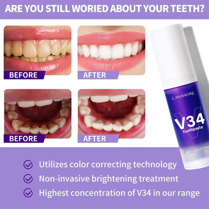 معجون أسنان 5d تبييض الأسنان v34 ، شرائط نظافة الفم ، أدوات العناية بالأسنان ، التنفس الطازج ، العناية بطبيب الأسنان