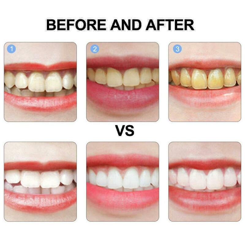 بروبيوتيك تبييض معجون الأسنان تبييض الأسنان المصل تسوس الأسنان إصلاح إزالة البلاك البقع الطازجة التنفس أدوات العناية بالأسنان
