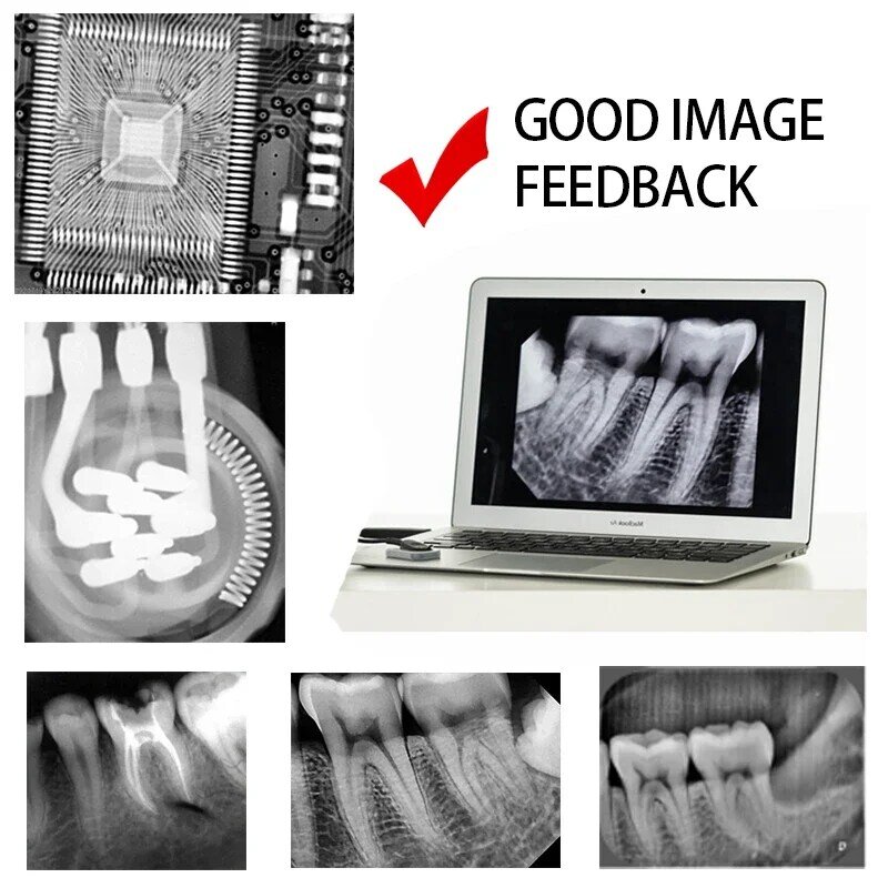 Greatlife-كاميرا جهاز أشعة سينية للأسنان ، RVG لاسلكي ، نظام مستشعر الصور ، محمول ، إضاءة فائقة أصلية ، Mexico RU ، EU ، متوفر
