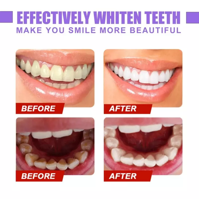 V34 مصل مصحح ملون معجون اسنان لتبييض الاسنان V34 مصحح الالوان مهني لتبييض الاسنان النظافة