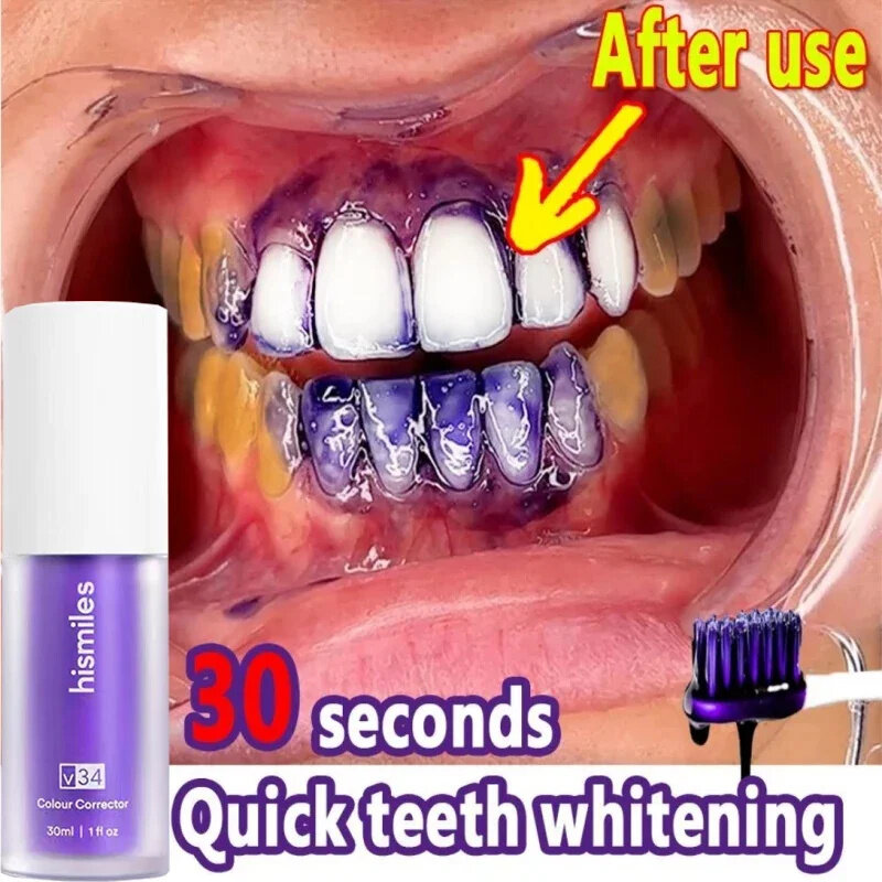 V34 سيروم معجون أسنان مبيض ، إزالة بقع البلاك ، نظافة الفم ، التنظيف ، أدوات تبييض الأسنان ، التنفس الطازج ، العناية بالأسنان
