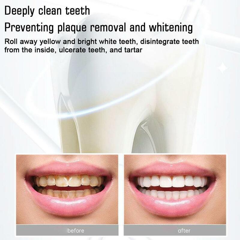 إصلاح تجاويف تسوس إزالة بقع البلاك تبييض معجون الأسنان جديد 2023 اصفرار الأسنان إصلاح الأسنان Dec T1B2