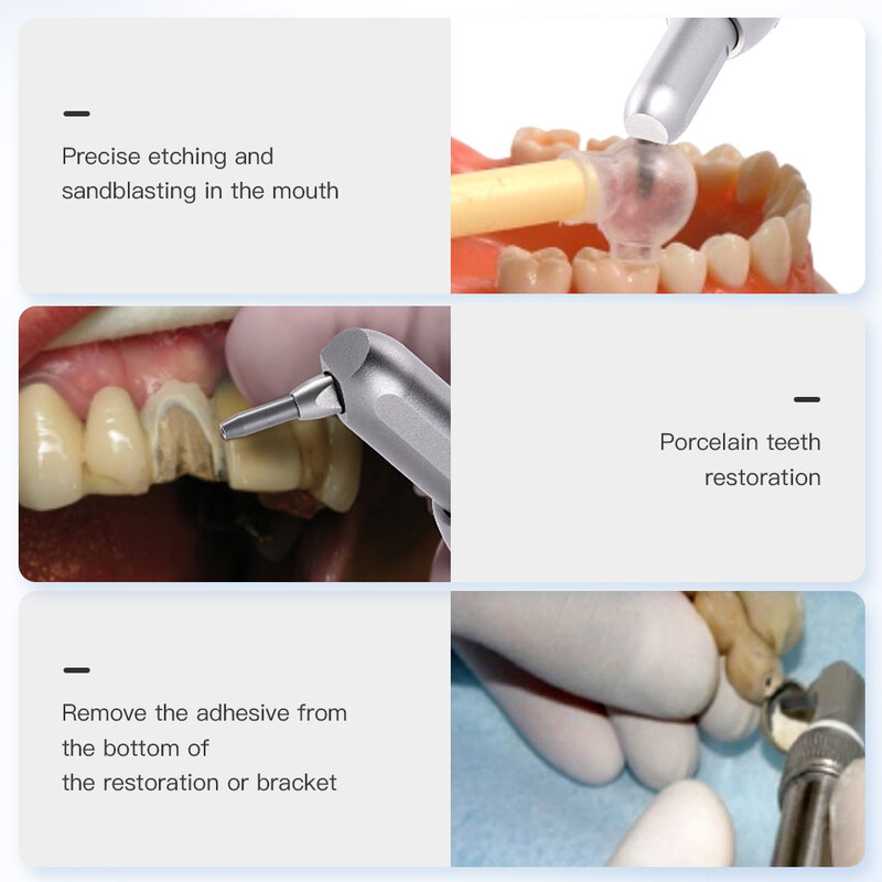 AZDENT-الأسنان أكسيد الألومنيوم مايكرو الناسف واجهة ، Microetcher الرملي ، مسدس الألومينا ، الملمع كشط الهواء ، أدوات طب الأسنان