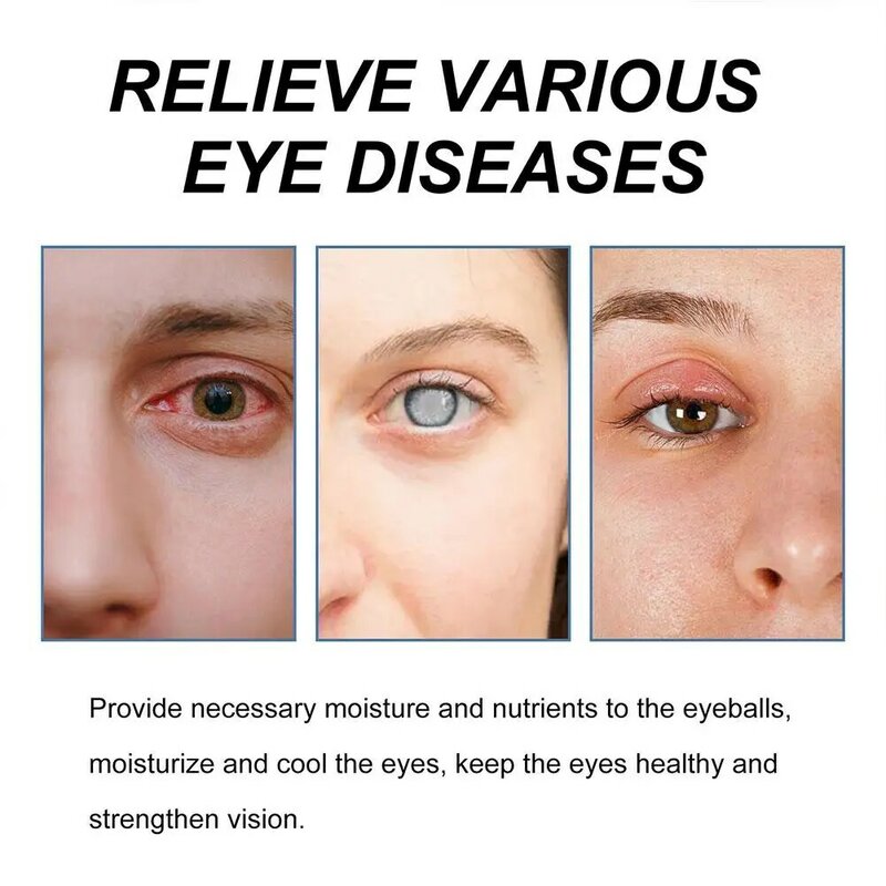 سائل العين لعلاج إعتام عدسة العين ، علاج التعب ، استعادة الراحة ، قطرات الرؤية ، يخفف البصر ، مقلة حكة ، قمع الجفاف ، N4A1