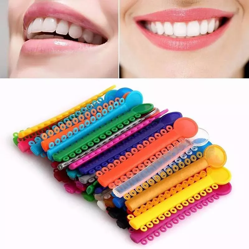 تقويم الأسنان العلاقات الرباط مطاطا ، وحدات ربط متعددة الألوان ، مواد طب الأسنان ، 40 قطعة للكيس الواحد