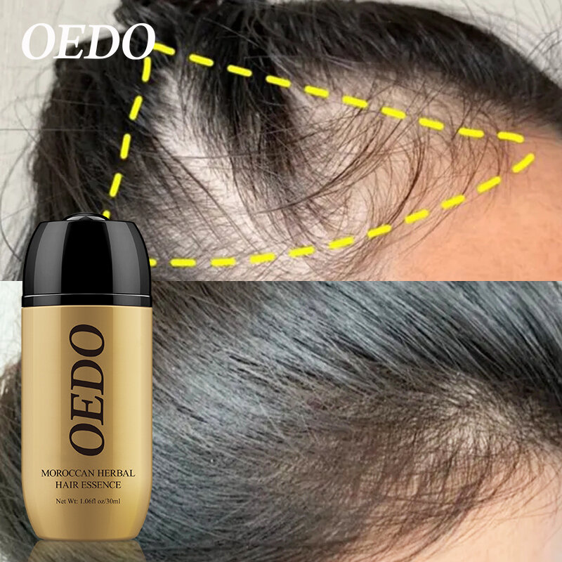 المغرب الجينسنغ معالجة الشعر بالكرياتين للرجال والنساء فقدان الشعر قوية العناية بالشعر النمو المصل إصلاح الشامبو لادور