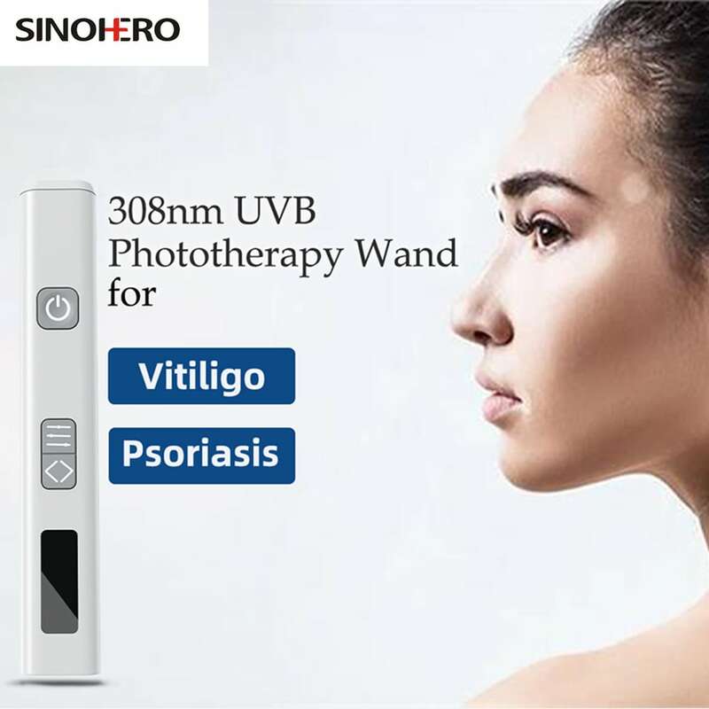مصباح Sinohero-UVB لعلاج البهاق Tratone و Psori-asis ، أداة 308nm