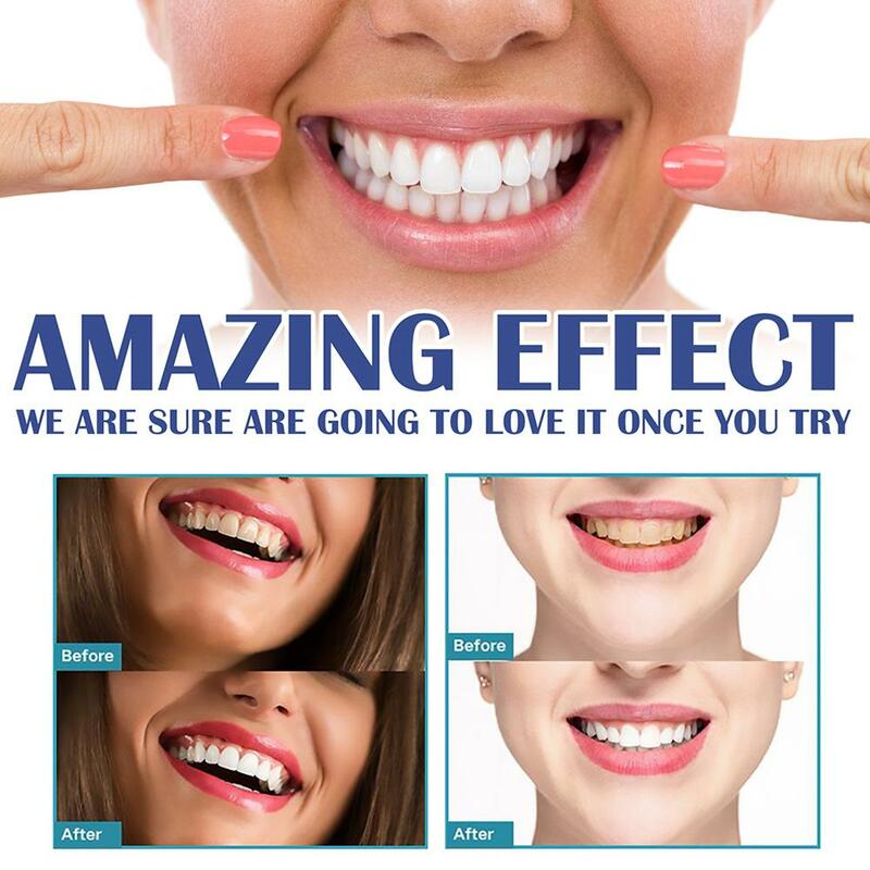 هلام الإغاثة اللثة لعلاج الأسنان ، ويخفف من التهاب اللثة ويبيض ، X2O2