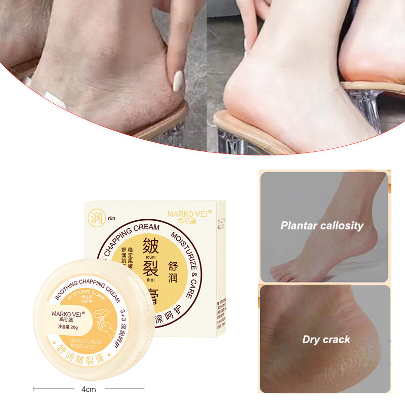 1 قطعة 20 جرام مكافحة التجفيف الكراك القدم كريم كعب متصدع إصلاح كريم إزالة الجلد الميت اليد قدم الرعاية