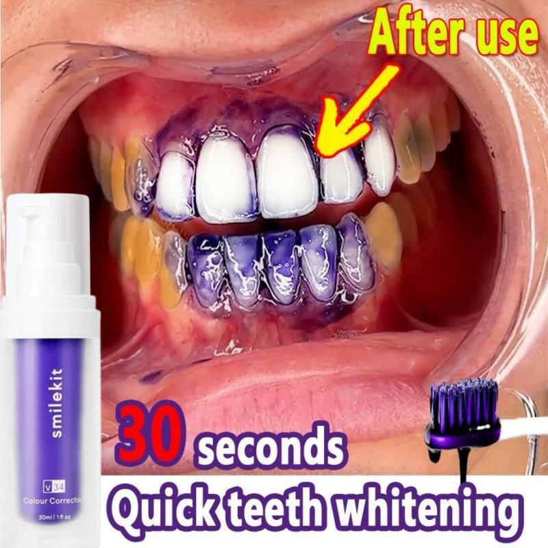 معجون أسنان لتنظيف الأسنان ، إصلاح تبييض ، تنعش الأسنان ، أسنان التنفس ، إزالة البقع ، تقليل الاصفرار ، العناية بالأسنان ، V34