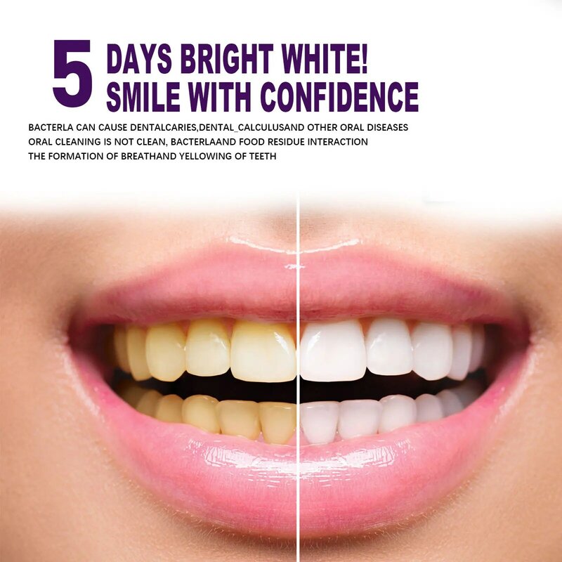 معجون أسنان مبيض أرجواني ، ينظف الفم ، تنفس منعش ، يزيل البقع الصفراء ، يحمي الأسنان ، عناية بإزالة التلوث الأبيض ، V34 ،