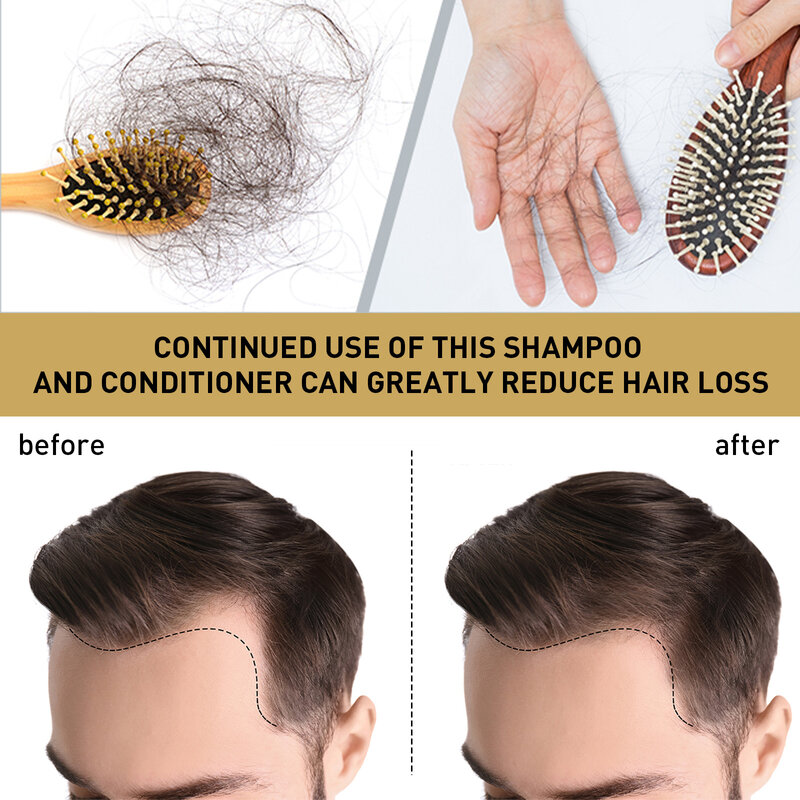 الزنجبيل نمو الشعر الشامبو مكافحة فقدان الشعر الشامبو منتجات العناية بالشعر مغذية فروة الرأس إصلاح أسرع إعادة نمو الشعر العلاج
