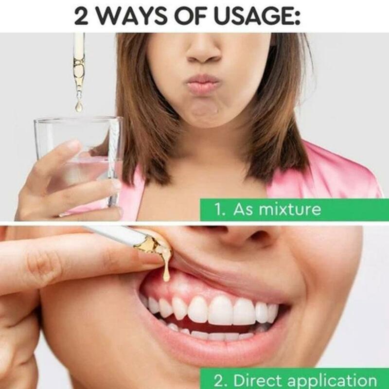 قطرات إصلاح اللثة ، تبييض الأسنان نظيفة ، وإزالة اللثة عن طريق الفم ، قطرات الصحية البقعية ، وتهدئة الرعاية ، A1X0 ، 30 مللي