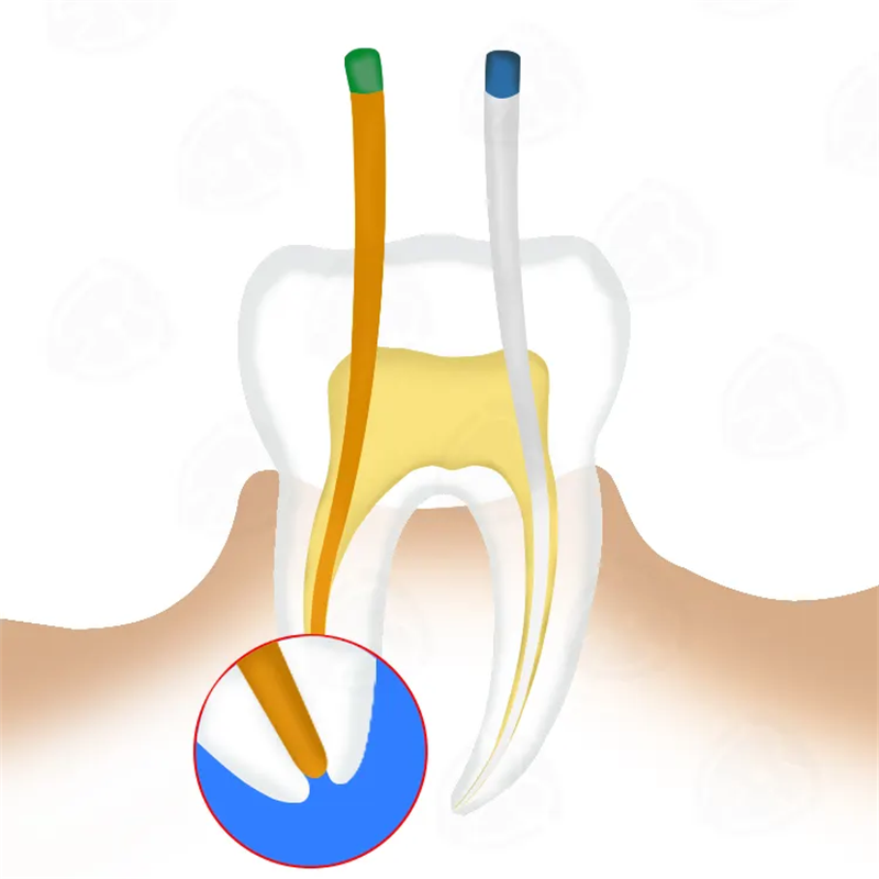 جيتا-نصائح ألياف القطن لطب الأسنان ، مواد غوتا ، نقاط جذر بيرشا ، أندودونتكس الأسنان ، GP تفتق القناة ، 02 ، 04 ، 06 ، # ، 15-40 ، F1-F3 ، 10 صناديق