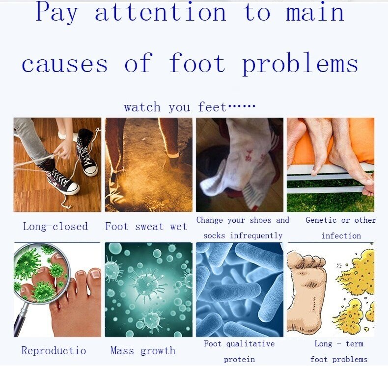100 مللي حذاء مزيل العرق رذاذ فعالة القدم والأحذية مزيل العرق رذاذ مزيل الروائح يدمر رائحة البكتيريا CR9
