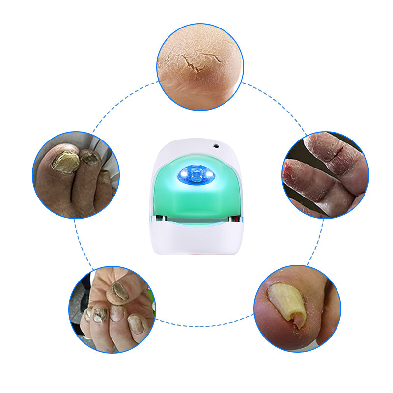 ATANG أظافر إصلاح تنظيف الأظافر جهاز ليزر فطريات الأظافر العلاج الباردة العلاج بالليزر العلاج الطبيعي