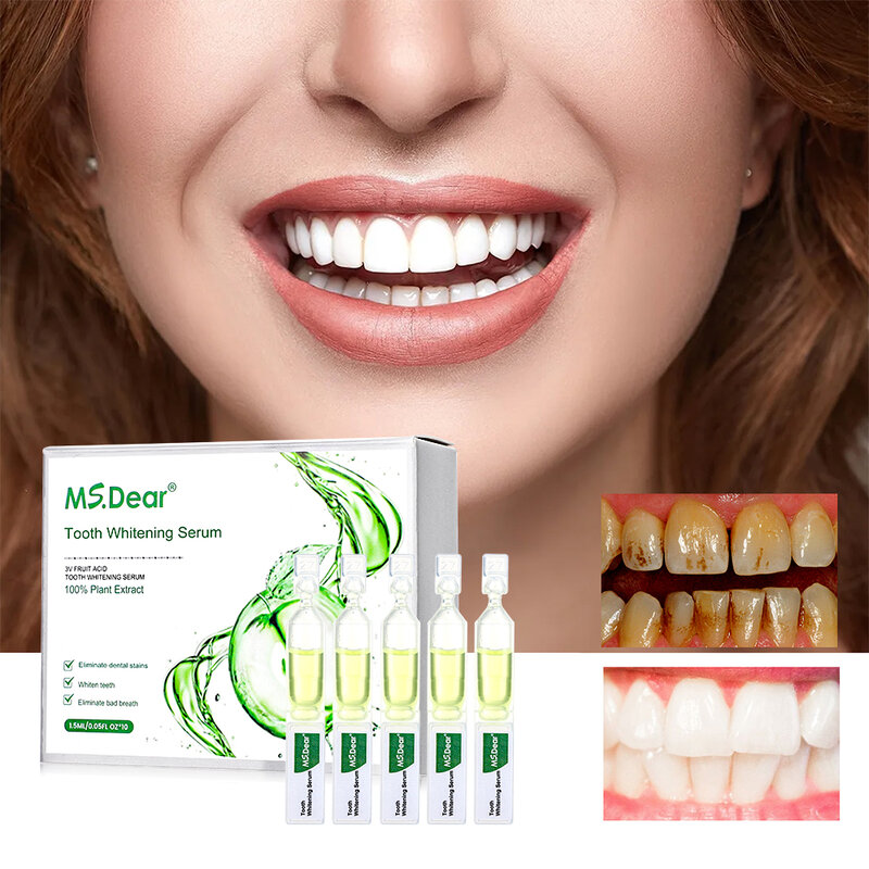 450/750 مللي تبييض الأسنان مصل إزالة البلاك البقع تنظيف الأسنان جوهر التنفس النقي العناية بصحة الفم منتجات طب الأسنان