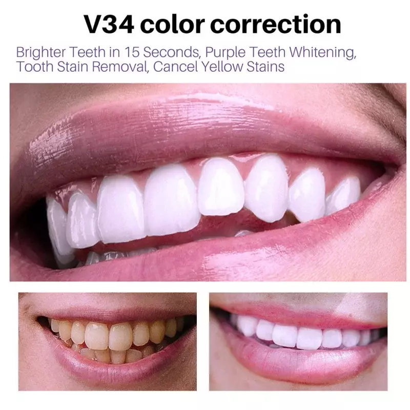 معجون أسنان موس V34 لتنظيف الفم ، معجون أسنان تبييض ، أصفر إزالة بقع الأسنان ، نظافة الفم ، 50 مللي ، 2023 ، جديد
