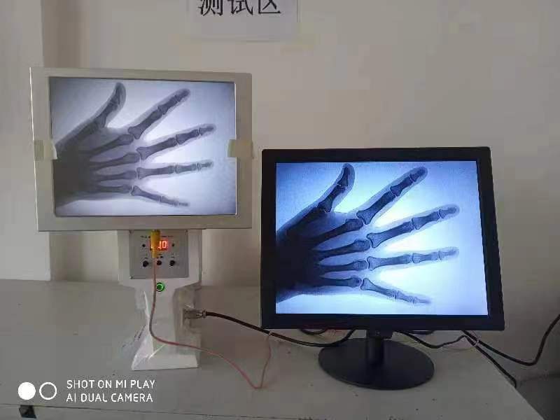 جهاز الأشعة السينية المحمولة جهاز الأشعة السينية المحمولة أصغر سعر معدات التشخيص الأشعة السينية