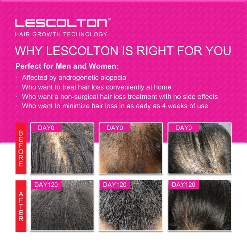 LESCOLTON الليزر نمو الشعر خوذة قبعة ليزر علاج تساقط الشعر للرجال والنساء منتجات إعادة نمو الشعر اللاسلكية قابلة للشحن
